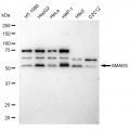 KD-Validated SMAD5 Rabbit mAb (20 μl)