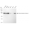 KD-Validated STIM1 Rabbit mAb (20 μl)