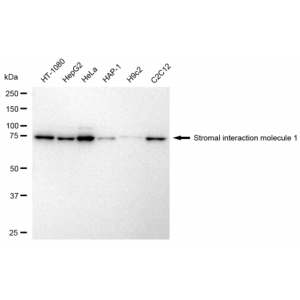 KD-Validated STIM1 Rabbit mAb (20 μl)