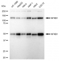KD-Validated NFKB1 Rabbit mAb (20 μl)