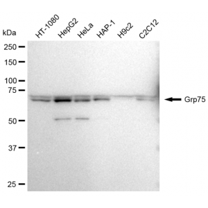 KD-Validated Grp75 Rabbit mAb (20 μl)