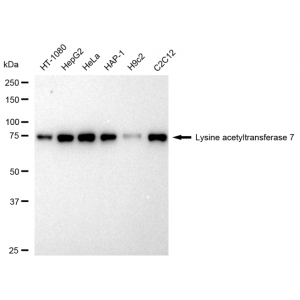 KD-Validated KAT7 Rabbit mAb (20 μl)