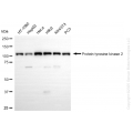 KD-Validated PTK2 Rabbit mAb (20 μl)