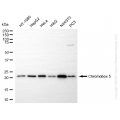 KD-Validated CBX5 Rabbit mAb (20 μl)