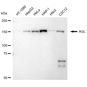 KD-Validated AGL Rabbit mAb (20 μl)