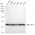 KD-Validated ARPC2 Rabbit mAb (20 μl)