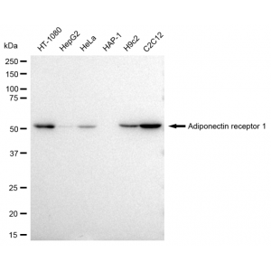 KD-Validated ADIPOR1 Rabbit mAb (20 μl)