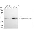 KD-Validated ILK Rabbit mAb (20 μl)