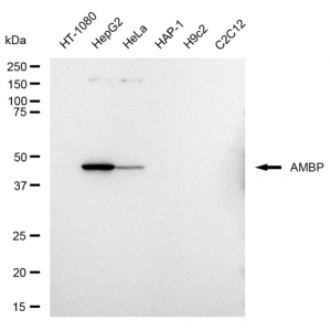 KD-Validated AMBP Rabbit mAb (20 μl)