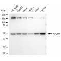 KD-Validated AP2M1 Rabbit mAb (20 μl)