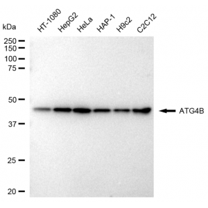 KD-Validated ATG4B Rabbit mAb (20 μl)