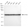 KD-Validated ATP5B Rabbit mAb (20 μl)