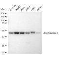 KD-Validated CASP2 Rabbit mAb (20 μl)