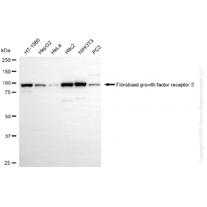 KD-Validated FGFR3 Rabbit mAb (20 μl)