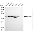 KD-Validated ACVRL1 Rabbit mAb (20 μl)