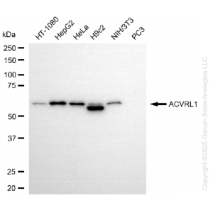 KD-Validated ACVRL1 Rabbit mAb (20 μl)