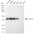 KD-Validated CCNE2 Rabbit mAb (20 μl)