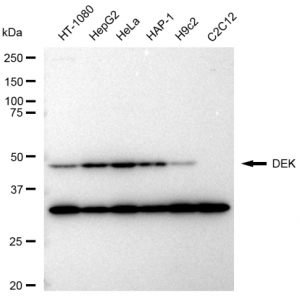 KD-Validated DEK Rabbit mAb (20 μl)