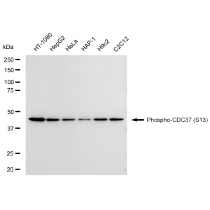 KD-Validated Phospho-CDC37 (S13) Rabbit mAb (20 μl)