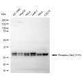 KD-Validated Phospho-Cdk2 (Y15) Rabbit mAb (20 μl)