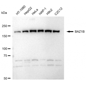 KD-Validated BAZ1B Rabbit mAb (20 μl)