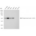 KD-Validated Phospho-ARRB1 (S412) Rabbit mAb (20 μl)