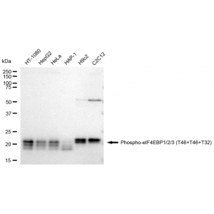 KD-Validated Phospho-eIF4EBP1/2/3 (T46+T46+T32) Rabbit mAb (20 μl)