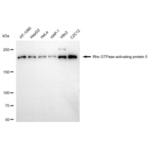 KD-Validated ARHGAP5 Rabbit mAb (20 μl)