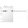 KD-Validated ADAR Rabbit mAb (20 μl)