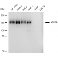 KD-Validated ATP7B Rabbit mAb (20 μl)