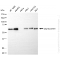 KD-Validated SQSTM1 Rabbit mAb (20 μl)