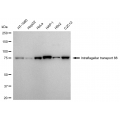 KD-Validated IFT88 Rabbit mAb (20 μl)