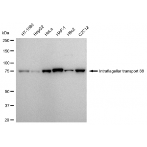 KD-Validated IFT88 Rabbit mAb (20 μl)