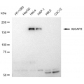KD-Validated IQGAP2 Rabbit mAb (20 μl)
