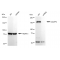 KD-Validated IQGAP2 Rabbit mAb (20 μl)
