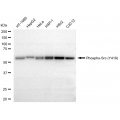 KD-Validated Phospho-Src (Y419) Rabbit mAb (20 μl)