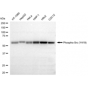 KD-Validated Phospho-Src (Y419) Rabbit mAb (20 μl)