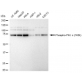 KD-Validated Phospho-PKCA (T638) Rabbit mAb (20 μl)