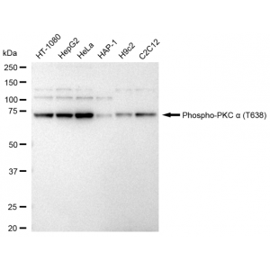 KD-Validated Phospho-PKCA (T638) Rabbit mAb (20 μl)