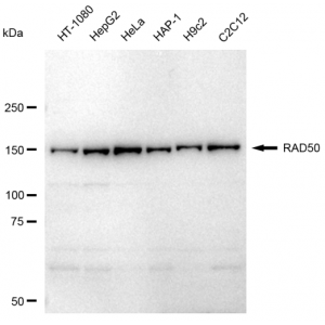 KD-Validated RAD50 Rabbit mAb (20 μl)