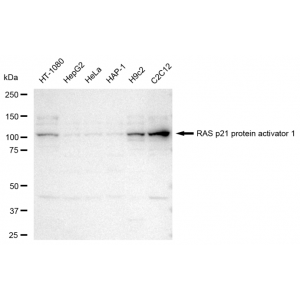 KD-Validated RASA1 Rabbit mAb (20 μl)