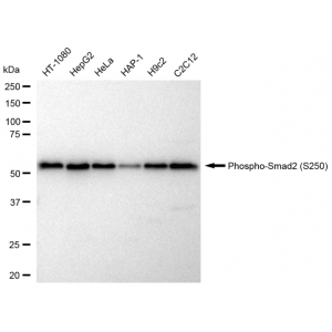 KD-Validated Phospho-Smad2 (S250) Rabbit mAb (20 μl)