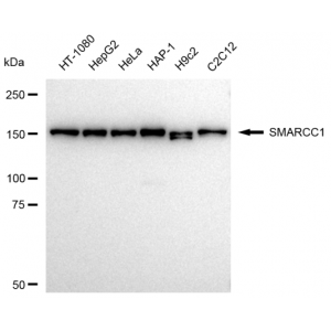 KD-Validated SMARCC1 Rabbit mAb (20 μl)