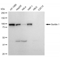 KD-Validated Sortilin 1 Rabbit mAb (20 μl)