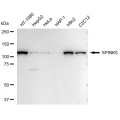 KD-Validated SPINK5 Rabbit mAb (20 μl)