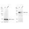 KD-Validated SPINK5 Rabbit mAb (20 μl)