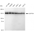 KD-Validated SUPT5H Rabbit mAb (20 μl)