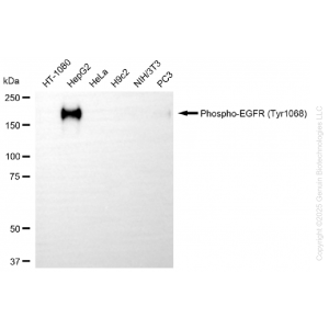 KD-Validated Phospho-EGFR (Tyr1068) Rabbit mAb (20 μl)