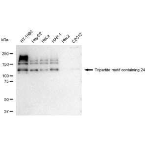 KD-Validated TRIM24 Rabbit mAb (20 μl)