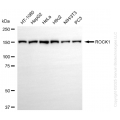KD-Validated ROCK1 Rabbit mAb (20 μl)